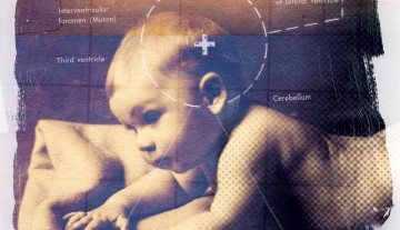 Autism Inc Discredited Science Shady >> Autism Inc The Discredited Science Shady Treatments And Rising Autism Inc Discredited Science Shady >> Autism Inc The Discredited Science Shady Treatments And Rising