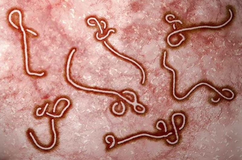 Ebola virus