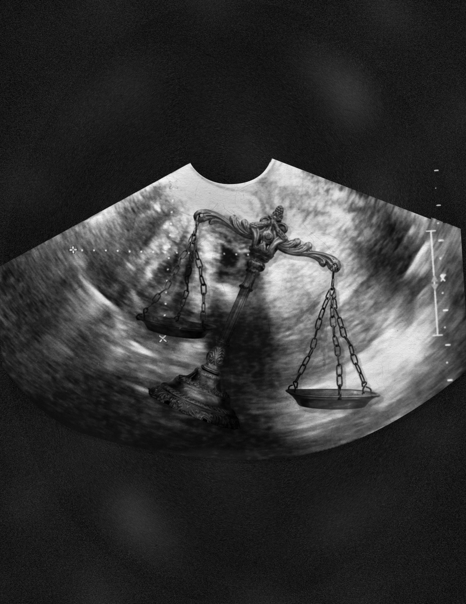 An illustration combining a sonogram of a womb with the image of a balancing scale, as if the scales of justice are inside the reproductive organ.