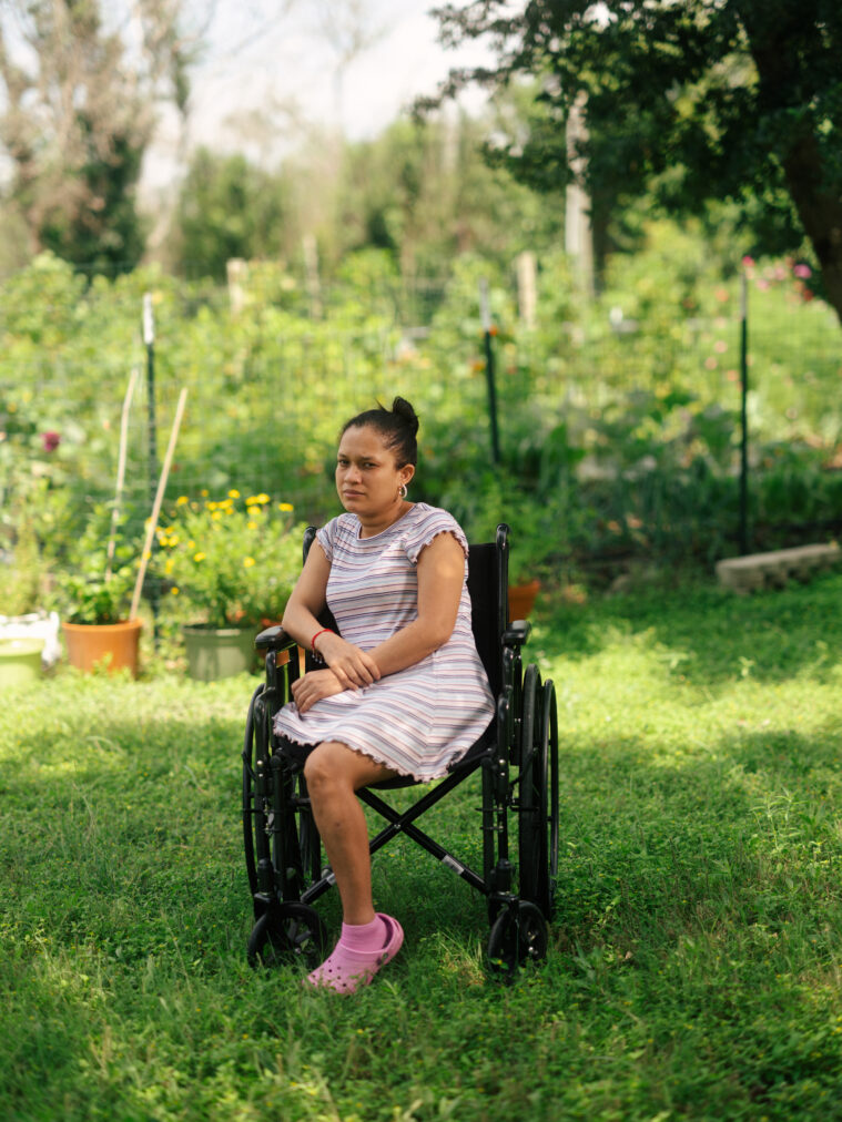 A one-legged woman sitting in a wheelchair outside with a pensive expression on her face.